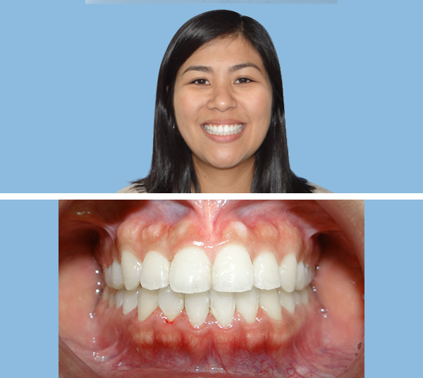 fotos intraorales para ortodoncia