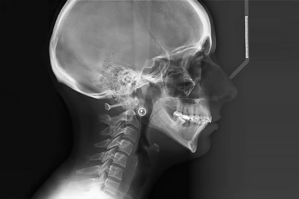 Radiografia cefalometrica en lima peru