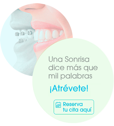 Ortodoncia sin brackets, Ortodoncia Perú, Ortodoncia Lima, Smile Perú, Ortognática Peru,Ortodoncia estética
