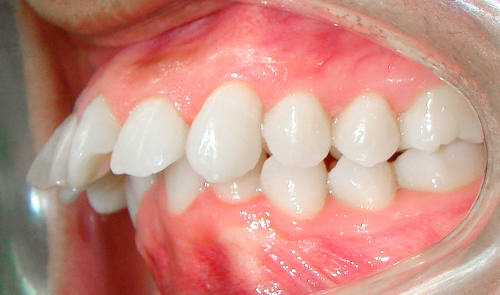Tratamientos de ortodoncia en lima